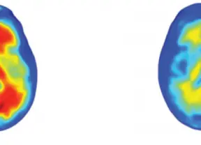 text